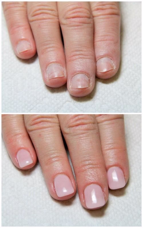 protez-tirnak-pendik